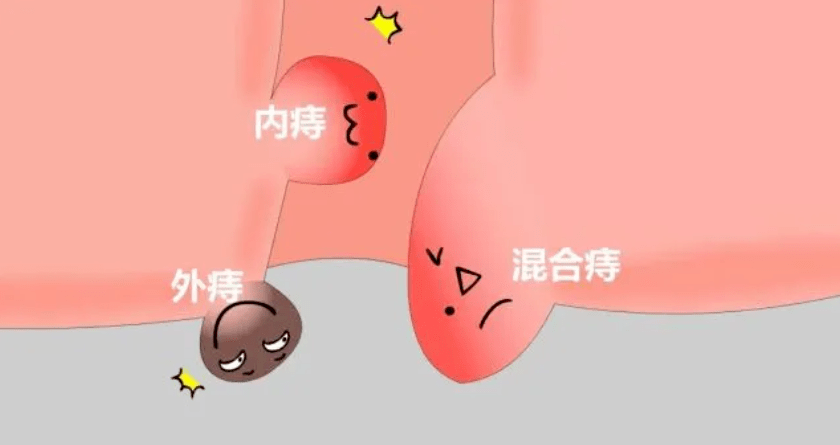 ̯@ʲô@ôʹ(dng)Ѫ˨